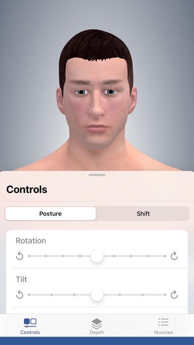 Emulate iPhone app 3D Cervical Dystonia using MyAndroid Emulate iPhone app 3D Cervical Dystonia using MyAndroid