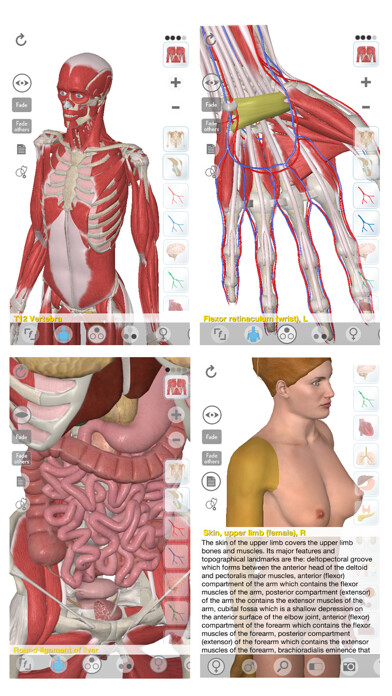 Emulate iPhone app 3D Organon Anatomy using MyAndroid Emulate iPhone app 3D Organon Anatomy using MyAndroid