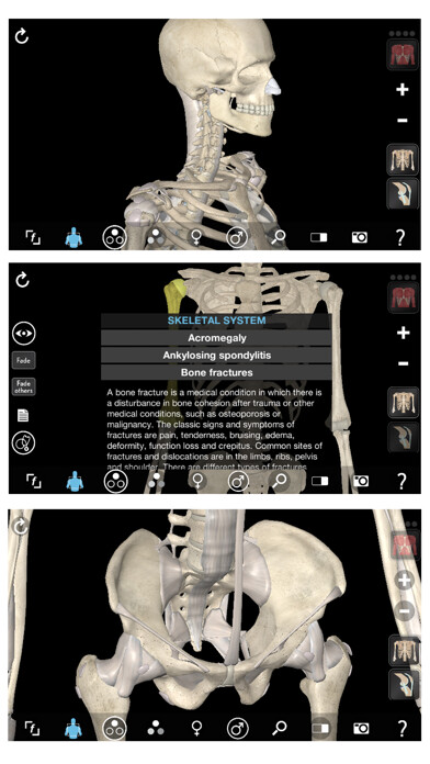 Emulate iPhone app 3D Organon Anatomy - Skeleton, Bones, and Ligaments using MyAndroid Emulate iPhone app 3D Organon Anatomy - Skeleton, Bones, and Ligaments using MyAndroid