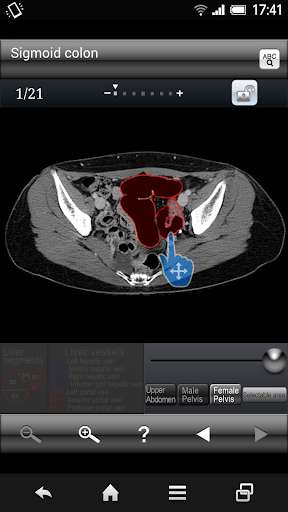 Run android online APK AbdominalCTSectionalWalkerLite from MyAndroid or emulate AbdominalCTSectionalWalkerLite using MyAndroid Run android online APK AbdominalCTSectionalWalkerLite from MyAndroid or emulate AbdominalCTSectionalWalkerLite using MyAndroid