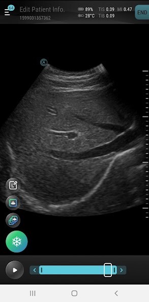 Run android online APK Aco Smartcare Apache Ultrasound App from MyAndroid or emulate Aco Smartcare Apache Ultrasound App using MyAndroid