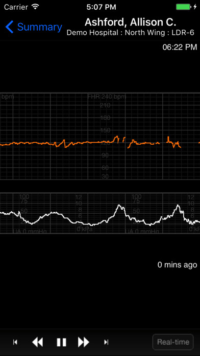 Emulate iPhone app AirStrip OB using MyAndroid Emulate iPhone app AirStrip OB using MyAndroid
