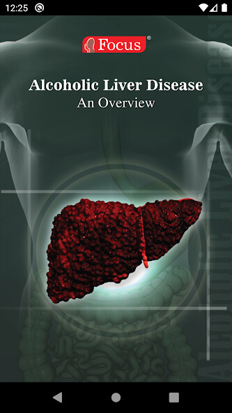 Run android online APK Alcoholic Liver Disease from MyAndroid or emulate Alcoholic Liver Disease using MyAndroid Run android online APK Alcoholic Liver Disease from MyAndroid or emulate Alcoholic Liver Disease using MyAndroid