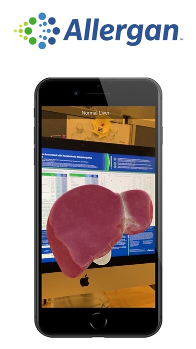 Emulate iPhone app Allergan AR using MyAndroid Emulate iPhone app Allergan AR using MyAndroid