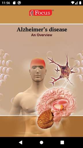 Run android online APK Alzheimer Disease from MyAndroid or emulate Alzheimer Disease using MyAndroid Run android online APK Alzheimer Disease from MyAndroid or emulate Alzheimer Disease using MyAndroid