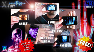 Emulate iPhone app Amazing X-Ray FX ² FREE+ using MyAndroid