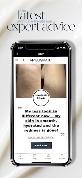 Run android online APK Ameliorate from MyAndroid or emulate Ameliorate using MyAndroid Run android online APK Ameliorate from MyAndroid or emulate Ameliorate using MyAndroid