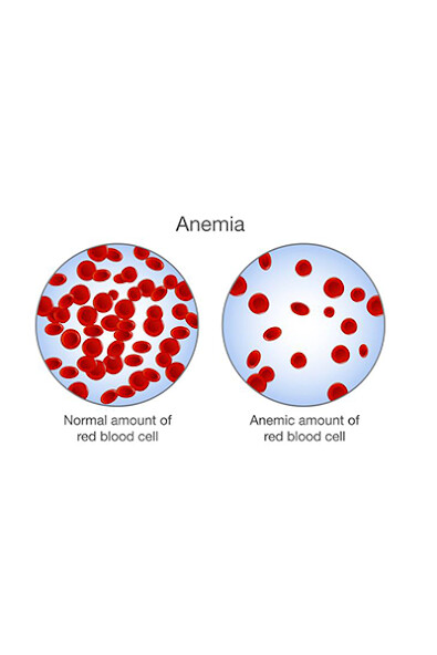 Emulate Android APK Anemia Emulate Android APK Anemia
