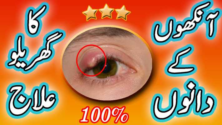 Emulate Android APK Ankho key Dano Ka Ilaj:Urdu Emulate Android APK Ankho key Dano Ka Ilaj:Urdu