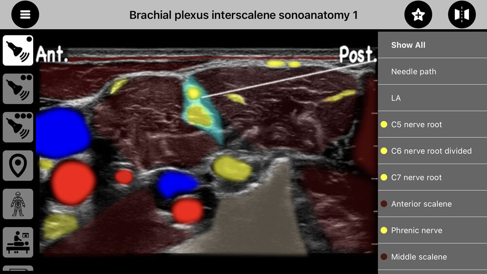 Run android online APK AnSo Anaesthesia Sonoanatomy from MyAndroid or emulate AnSo Anaesthesia Sonoanatomy using MyAndroid