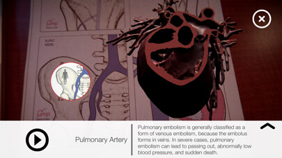 Emulate iPhone app AR Anatomy by Jump Simulation using MyAndroid Emulate iPhone app AR Anatomy by Jump Simulation using MyAndroid