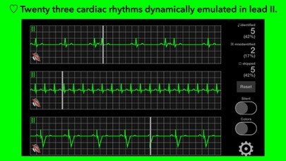 Emulate iPhone app arrhythmia using MyAndroid Emulate iPhone app arrhythmia using MyAndroid