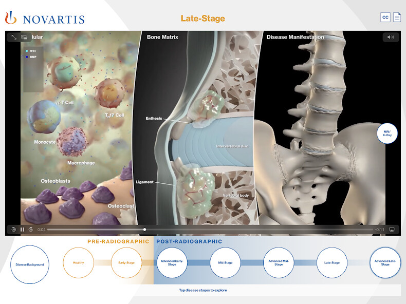 Run android online APK AS Disease Progression Visualizer from MyAndroid or emulate AS Disease Progression Visualizer using MyAndroid Run android online APK AS Disease Progression Visualizer from MyAndroid or emulate AS Disease Progression Visualizer using MyAndroid