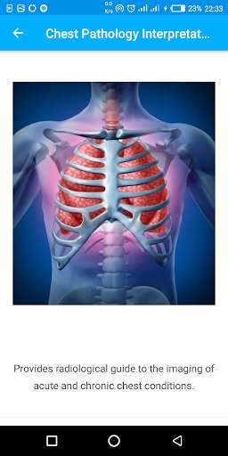 Run android online APK A-Z Chest X-Ray Pathology Guide from MyAndroid or emulate A-Z Chest X-Ray Pathology Guide using MyAndroid