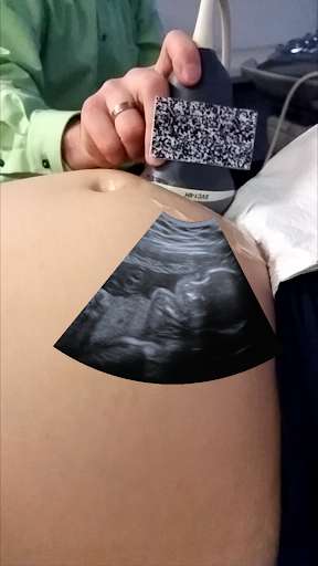 Run android online APK BabyAR from MyAndroid or emulate BabyAR using MyAndroid