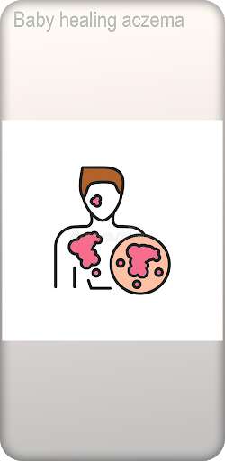 Run android online APK Baby healing aczema from MyAndroid or emulate Baby healing aczema using MyAndroid Run android online APK Baby healing aczema from MyAndroid or emulate Baby healing aczema using MyAndroid