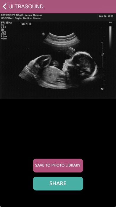 Emulate iPhone app Baby Ultrasound 2015 using MyAndroid