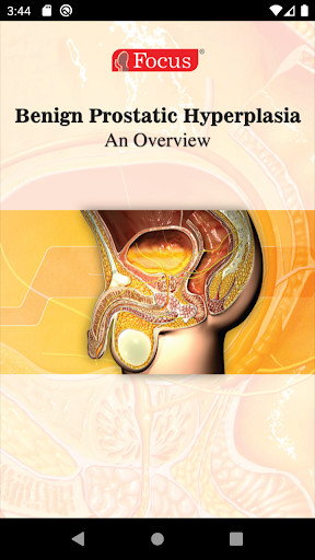 Run android online APK Benign Prostatic Hyperplasia from MyAndroid or emulate Benign Prostatic Hyperplasia using MyAndroid Run android online APK Benign Prostatic Hyperplasia from MyAndroid or emulate Benign Prostatic Hyperplasia using MyAndroid