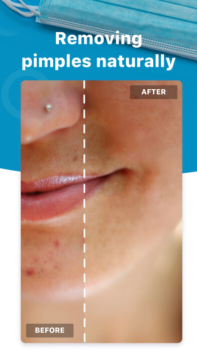 Emulate iPhone app Blemish Editor - Face Tuner using MyAndroid
