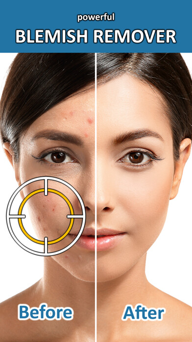 Emulate iPhone app Blemish Remover Photo Tool using MyAndroid Emulate iPhone app Blemish Remover Photo Tool using MyAndroid