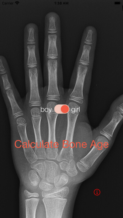Emulate iPhone app Bone Age using MyAndroid