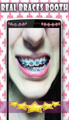 Emulate Android APK Braces Stickers Photo Booth Emulate Android APK Braces Stickers Photo Booth