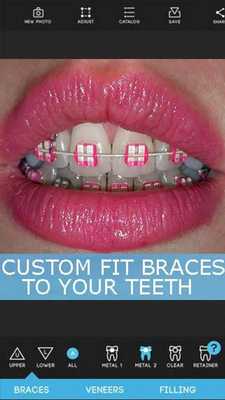 Emulate Android APK Braces Teeth Booth Pro Camera Emulate Android APK Braces Teeth Booth Pro Camera
