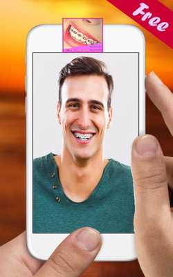 Emulate Android APK Braces Teeth Booth Selfie Emulate Android APK Braces Teeth Booth Selfie