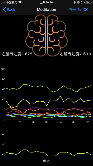 Emulate iPhone app BrainLink Dual using MyAndroid Emulate iPhone app BrainLink Dual using MyAndroid