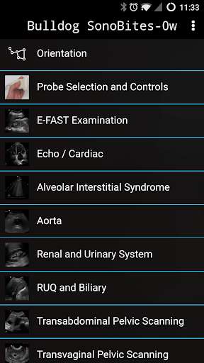 Run android online APK Bulldog SonoBites from MyAndroid or emulate Bulldog SonoBites using MyAndroid