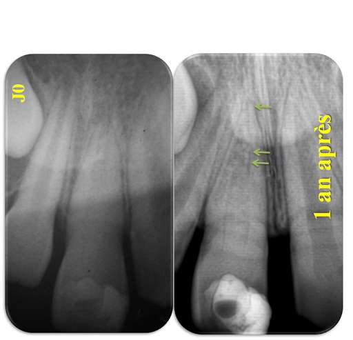 Run android online APK Cabinet smile (Dent immature) from MyAndroid or emulate Cabinet smile (Dent immature) using MyAndroid