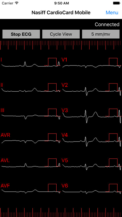 Emulate Android APK CardioCardMobile Emulate Android APK CardioCardMobile