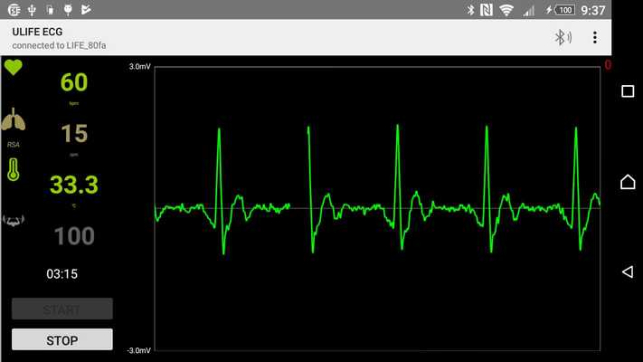 Emulate Android APK CCH ECG Emulate Android APK CCH ECG