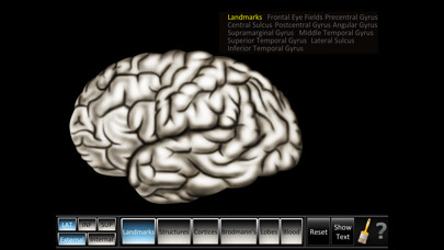 Emulate iPhone app Cerebrum ID using MyAndroid Emulate iPhone app Cerebrum ID using MyAndroid
