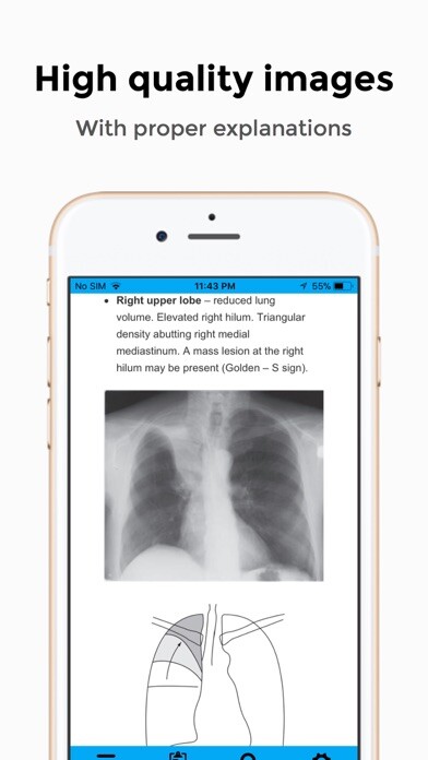 Emulate iPhone app Chest X-Ray FlashCards using MyAndroid Emulate iPhone app Chest X-Ray FlashCards using MyAndroid
