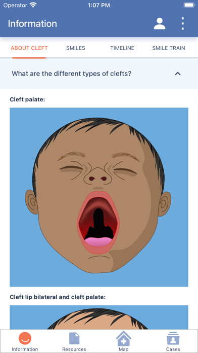Emulate iPhone app Cleft Care Companion using MyAndroid Emulate iPhone app Cleft Care Companion using MyAndroid