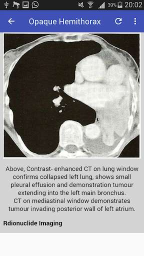 Emulate Android APK Clinical Chest Radiology Emulate Android APK Clinical Chest Radiology