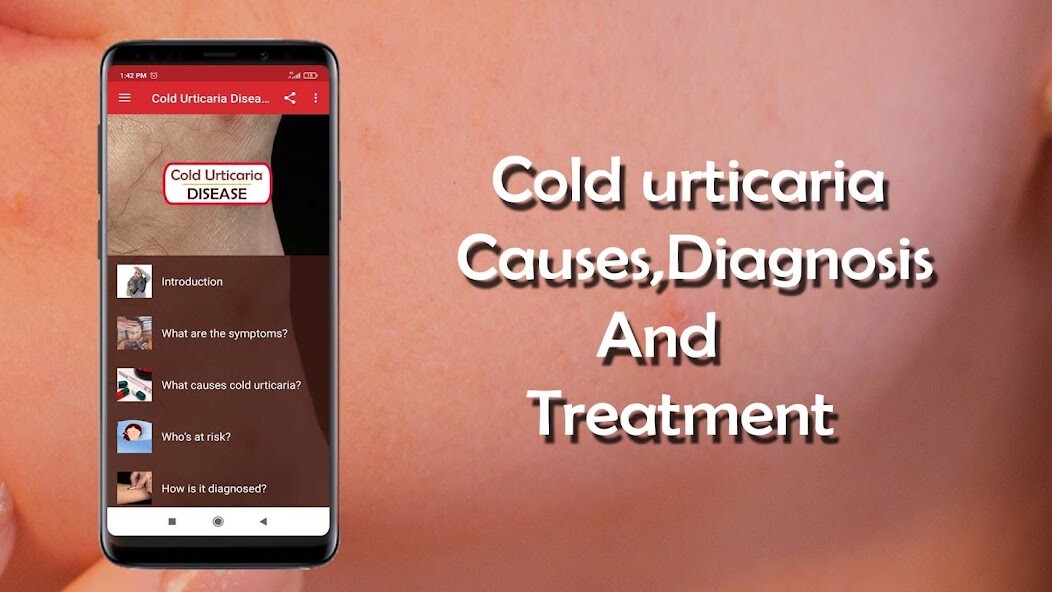 Run android online APK Cold urticaria - Causes, Diagn from MyAndroid or emulate Cold urticaria - Causes, Diagn using MyAndroid Run android online APK Cold urticaria - Causes, Diagn from MyAndroid or emulate Cold urticaria - Causes, Diagn using MyAndroid