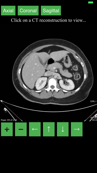 Run android online APK CT Abdomen Pelvis from MyAndroid or emulate CT Abdomen Pelvis using MyAndroid