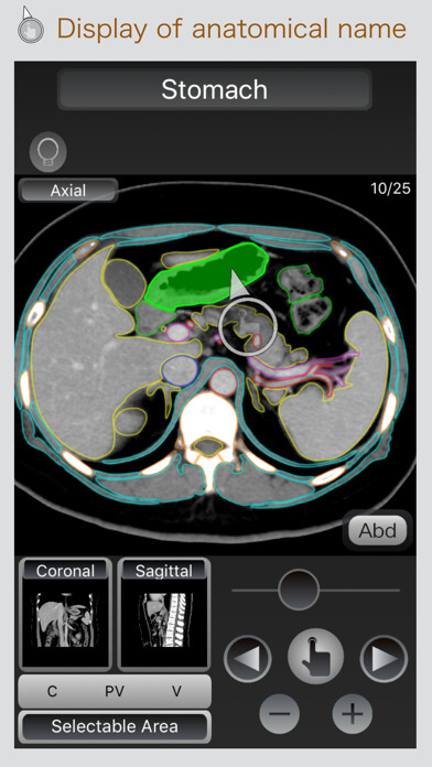 Emulate iPhone app CT Passport Abdomen using MyAndroid