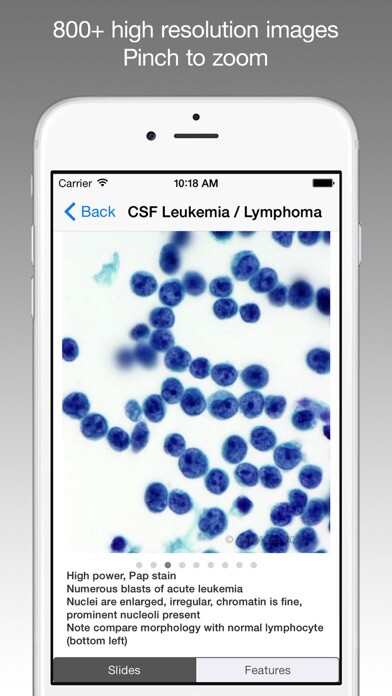 Emulate iPhone app CytoAtlas using MyAndroid Emulate iPhone app CytoAtlas using MyAndroid