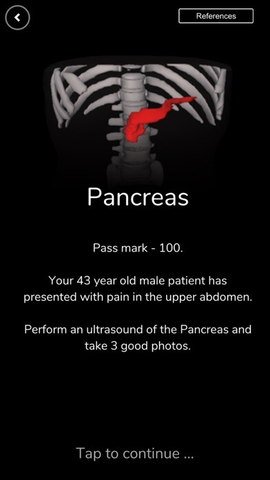 Emulate iPhone app Deepscope Ultrasound Simulator using MyAndroid Emulate iPhone app Deepscope Ultrasound Simulator using MyAndroid