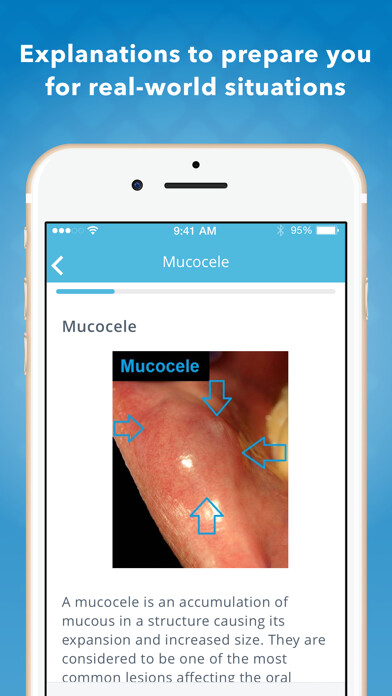 Emulate iPhone app Dental Clinical Mastery using MyAndroid Emulate iPhone app Dental Clinical Mastery using MyAndroid