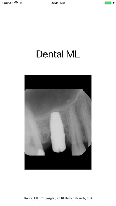 Emulate iPhone app Dental ML using MyAndroid Emulate iPhone app Dental ML using MyAndroid