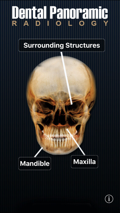 Emulate iPhone app Dental Panoramic Radiology using MyAndroid Emulate iPhone app Dental Panoramic Radiology using MyAndroid