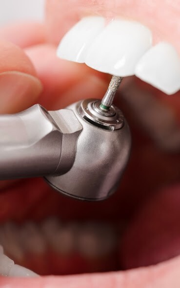Run android online APK Dentist Drill Sounds from MyAndroid or emulate Dentist Drill Sounds using MyAndroid Run android online APK Dentist Drill Sounds from MyAndroid or emulate Dentist Drill Sounds using MyAndroid