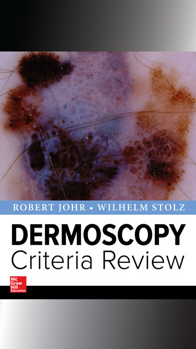Emulate iPhone app Dermoscopy Criteria Review using MyAndroid Emulate iPhone app Dermoscopy Criteria Review using MyAndroid