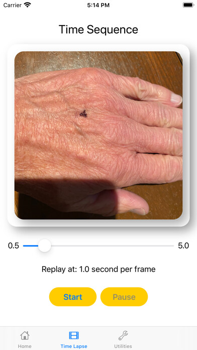 Emulate iPhone app DermShot using MyAndroid
