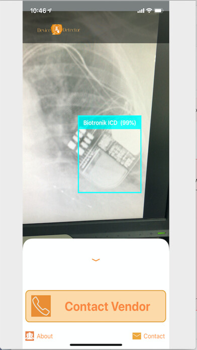 Emulate iPhone app Device Detector using MyAndroid Emulate iPhone app Device Detector using MyAndroid