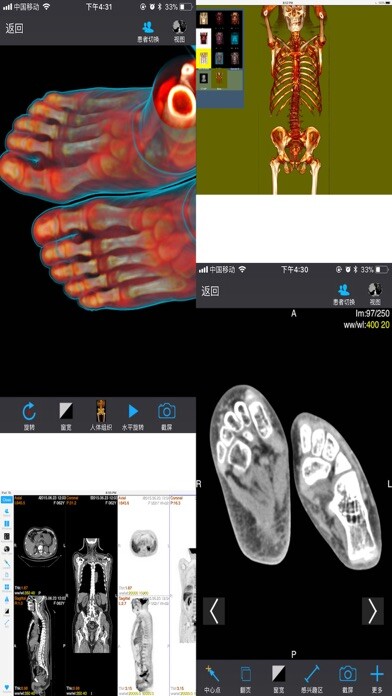 Emulate iPhone app Dicom3D - Easy and Powerful using MyAndroid